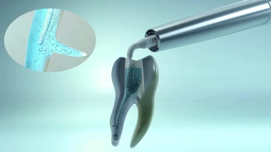 Root Canal Irrigators Market Analysis, Trends & Growth Forecast