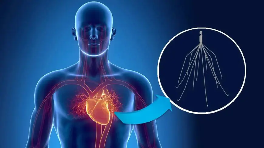 Inferior Vena Cava (IVC) Filter Market Analysis: Growth, Trends 2024-2034